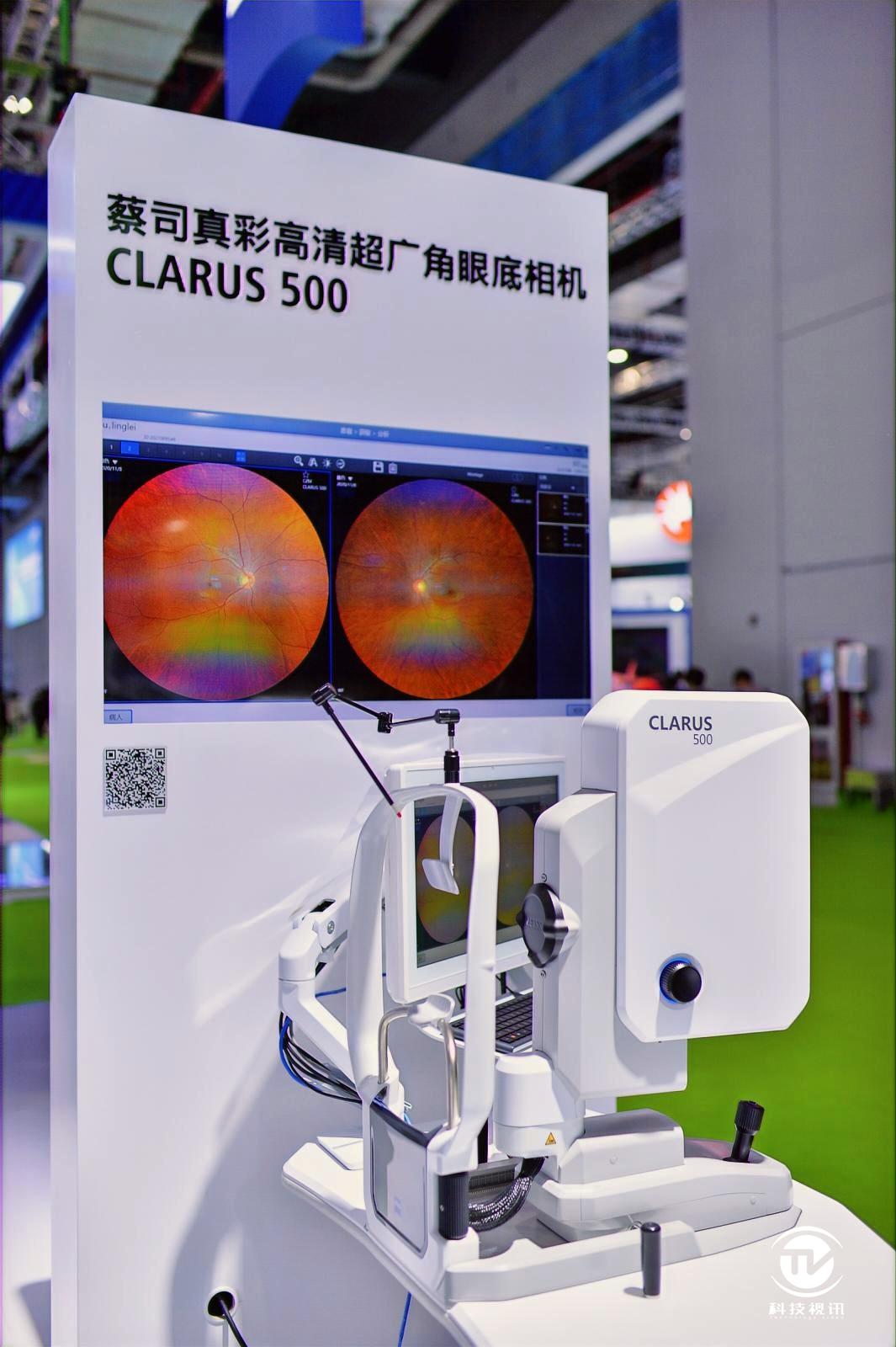 眼底相机clarus 500,60秒就能描绘精准眼屈光地图的蔡司屈光分析仪,3